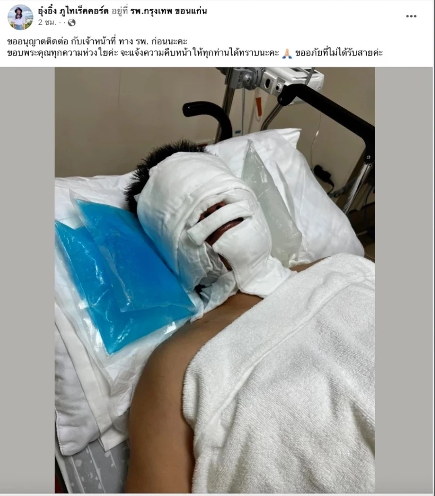 อัปเดตอาการ ไฟคลอก“จินนี่ ภูไท” หลังหมอเปิดผ้าพันแผล