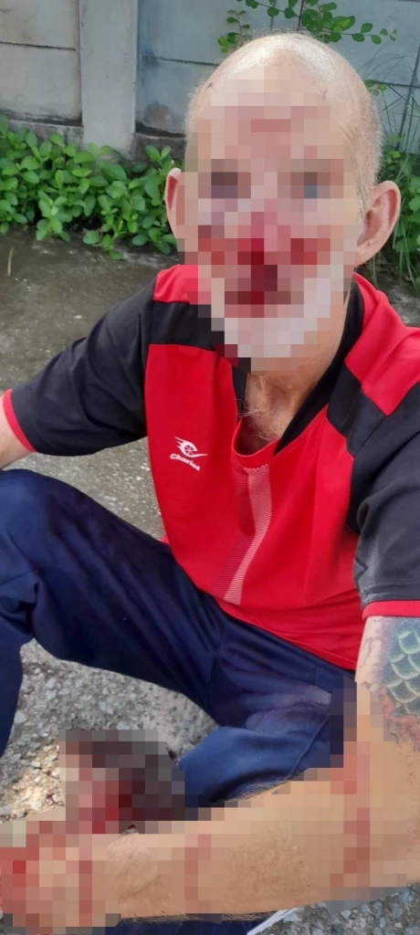 ฝรั่งร้องสายไหมฯ เพื่อนร่วมหมู่บ้าน ทำร้าย - ขู่ฆ่า ปมเข้าใจผิดอุบัติเหตุ