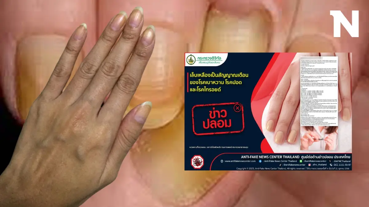 ไขข้อสงสัย เล็บเหลืองเป็นสัญญาณเตือนเบาหวาน ปอด ไทรอยด์ จริงหรือเท็จกันแน่