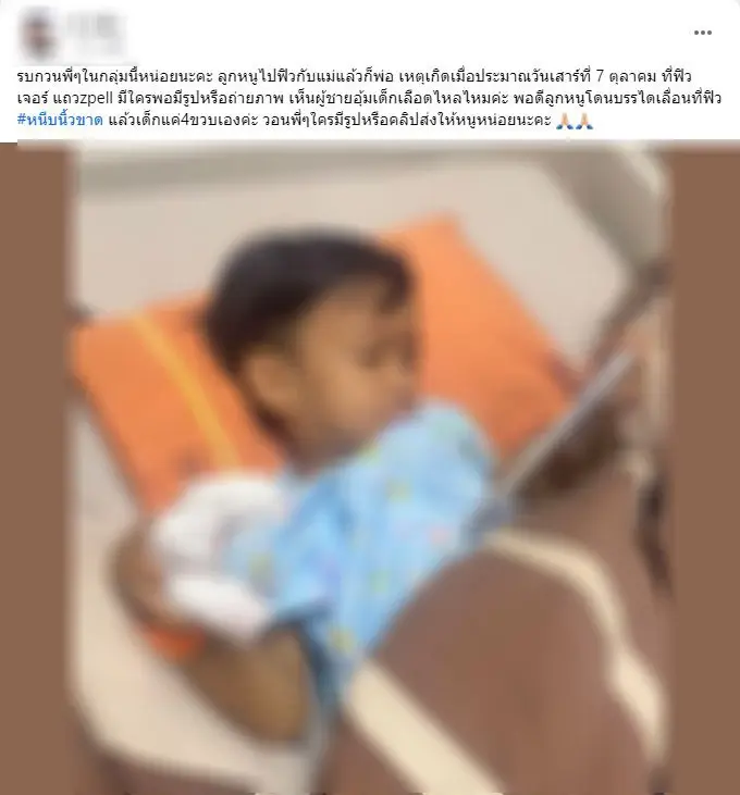 ห้างดังเสียใจ บันไดเลื่อนหนีบนิ้วเด็ก 4 ขวบ ยันไม่ได้เกิดจากตัวอุปกรณ์
