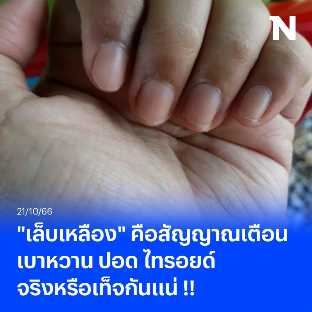 ไขข้อสงสัย เล็บเหลืองเป็นสัญญาณเตือนเบาหวาน ปอด ไทรอยด์ จริงหรือเท็จกันแน่