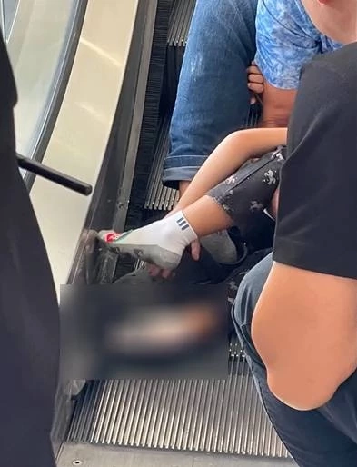 เด็กหญิง วัย 4 ขวบ เท้าติดบันไดเลื่อนห้างดัง แม่ติดใจการช่วยเหลือล่าช้า