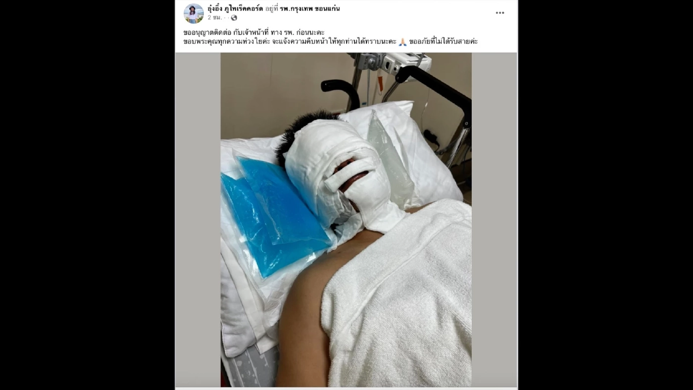 ด่วน! “จินนี่ ภูไท” นักแต่งเพลงลูกทุ่งดัง ถูกไฟคลอกอาการสาหัส