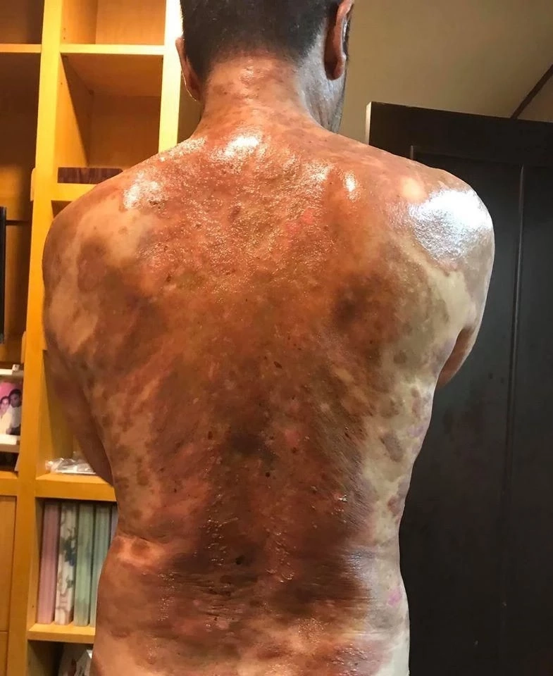 หนุ่ม คงกระพัน อัปเดตอาการป่วยเพื่อนรัก หลังวอน "อ.ไพศาล" เปิดนิมิตช่วยรักษา 