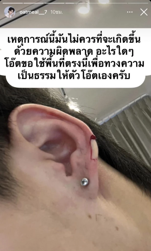 ช็อก "นักแสดงหนุ่ม" ไปตัดผมแต่ถูกตัดหู สุดทนปล่อยโฮร้องขอความเป็นธรรม