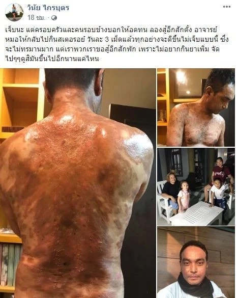 หนุ่ม คงกระพัน อัปเดตอาการป่วยเพื่อนรัก หลังวอน "อ.ไพศาล" เปิดนิมิตช่วยรักษา 