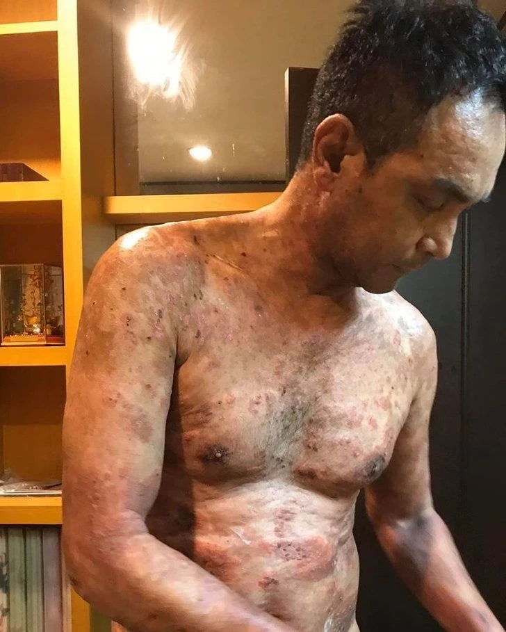 หนุ่ม คงกระพัน อัปเดตอาการป่วยเพื่อนรัก หลังวอน "อ.ไพศาล" เปิดนิมิตช่วยรักษา 