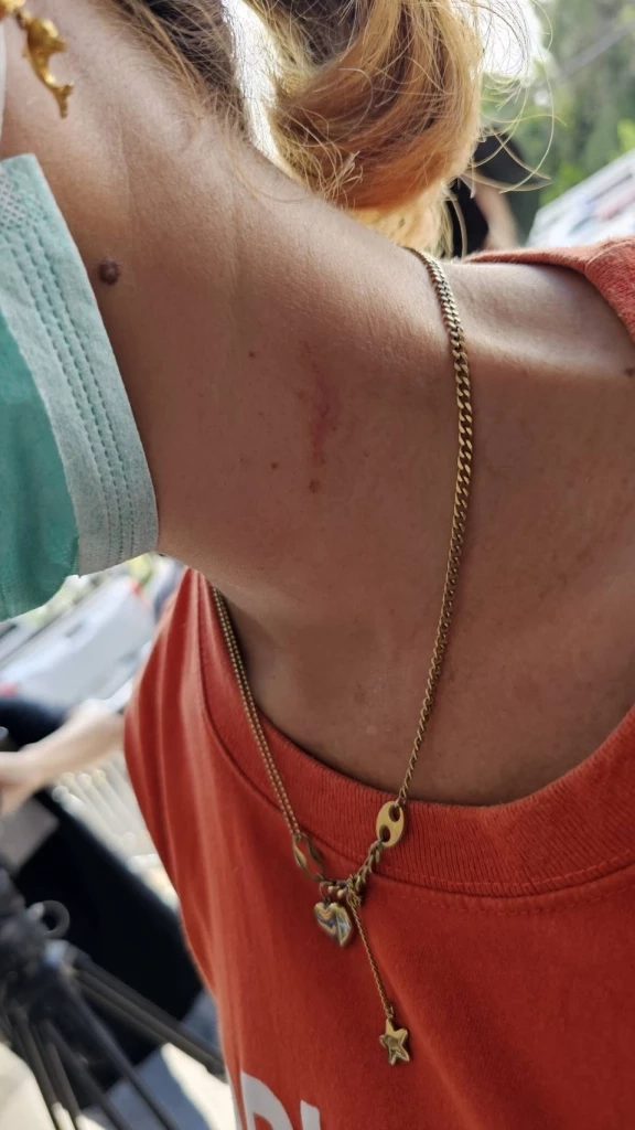 ภรรยาผู้ตาย เผยร่องรอยการถูกทำร้าย จากฝีมีอกลุ่มอันธพาลหมู่ วัยรุ่น ย่านดอนเมือง 