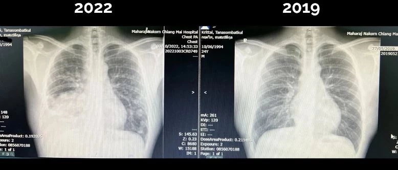 Rerun ส่งกำลังใจ "หมอกฤตไท" เพจสู้ดิวะ ต่อสู้มะเร็งปอดระยะสุดท้าย จนถึงวันสุดท้ายของชีวิต