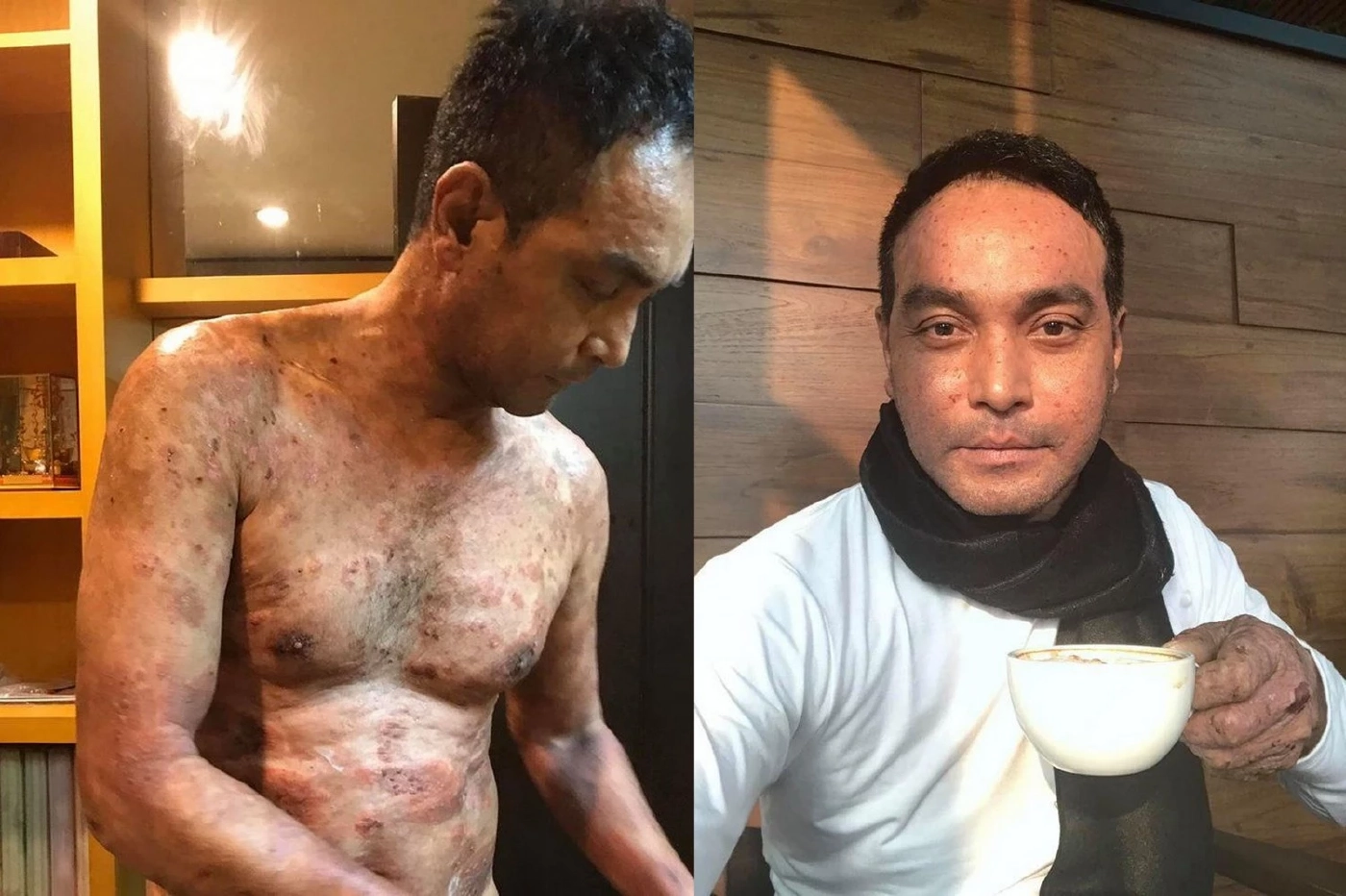 หนุ่ม คงกระพัน อัปเดตอาการป่วยเพื่อนรัก หลังวอน "อ.ไพศาล" เปิดนิมิตช่วยรักษา 