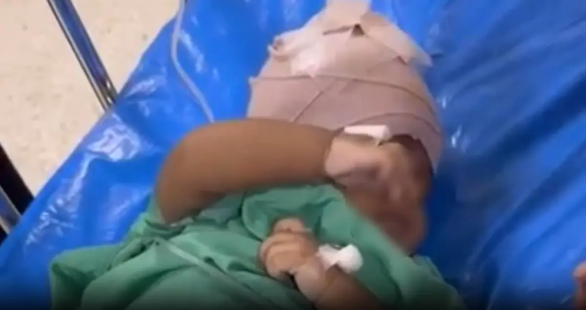 ผู้ว่าฯ พังงา ส่งทีมดูแลเด็กถูกลิงกัด เร่งแก้ปัญหาฝูงลิงแสมบนเกาะไม้ไผ่