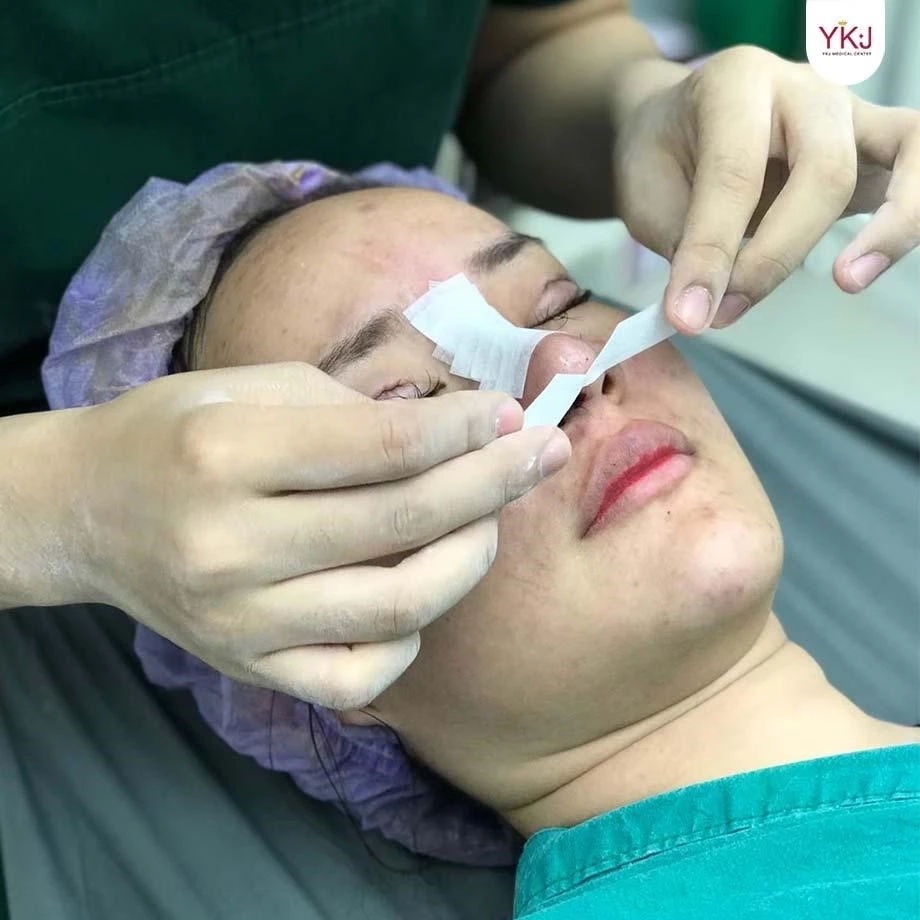 ทำไมต้องแก้จมูก? เรื่องที่ควรรู้ก่อนแก้จมูก