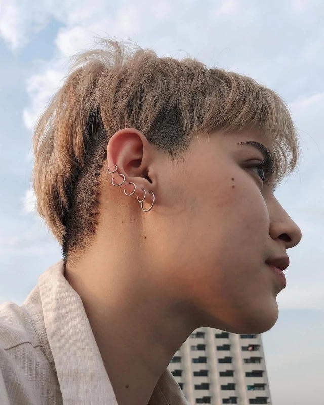 "นิ้ง ชัญญา" โอดเจอโรคใหม่ หลังปีที่แล้วเพิ่งผ่าตัดเนื้องอกในสมองออกไป