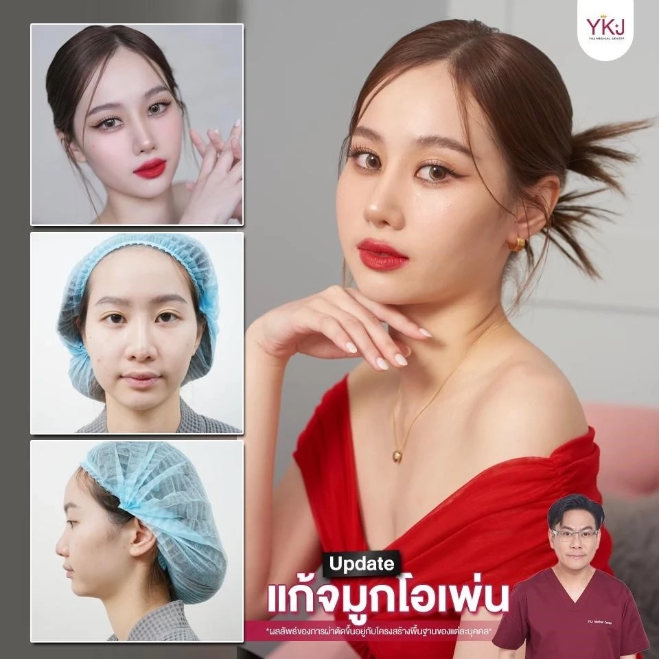 ทำไมต้องแก้จมูก? เรื่องที่ควรรู้ก่อนแก้จมูก