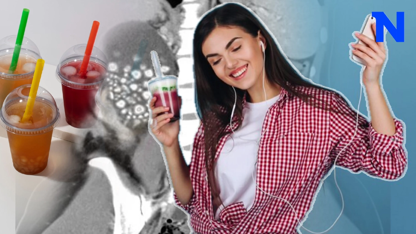 เตือนสายติดชง-ติดหวาน-ดื่มน้ำน้อย ระวัง “โรคนิ่วในไต” ปรับพฤติกรรมด่วน!!