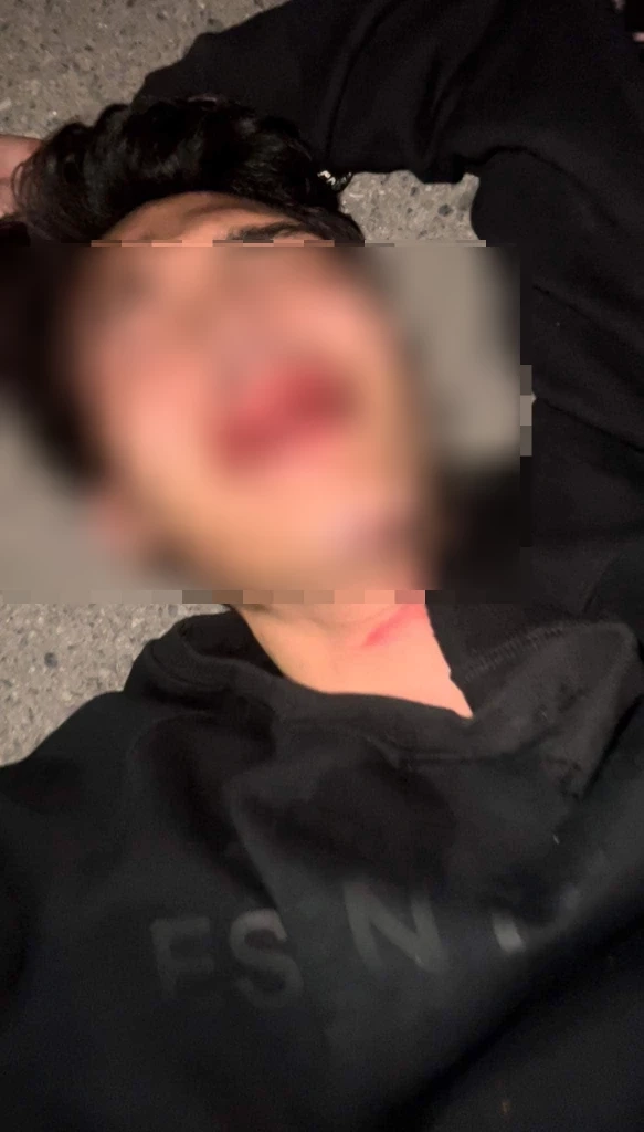 แม่เดือด การ์ด"ผับดัง"ชลบุรี พังห้องน้ำ รุมทำร้ายลูกสาหัส อ้างคิดว่าอัพยา