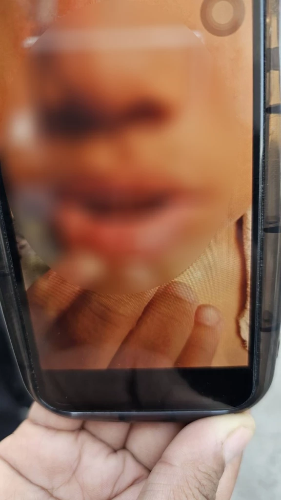 ผู้ปกครองเด็กที่ถูก 'ครูใช้เข็มจิ้มปาก' รับไม่ได้ อยากให้ออกจากการเป็นครู