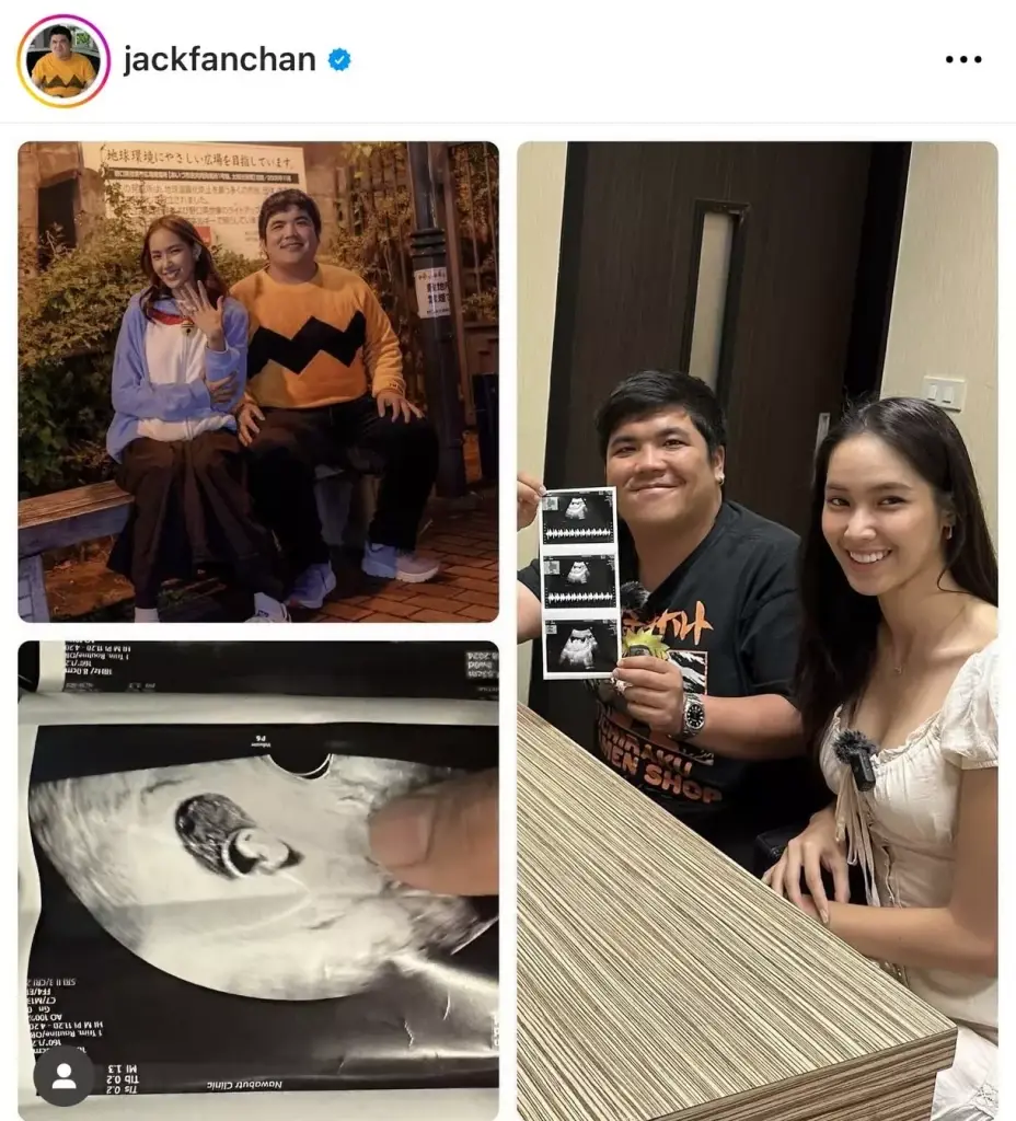 มีความสุขสุดๆ "แจ็ค แฟนฉัน" อวดภาพอัลตร้าซาวด์ลูกคนแรกบอกรักเมียหวานฉ่ำ