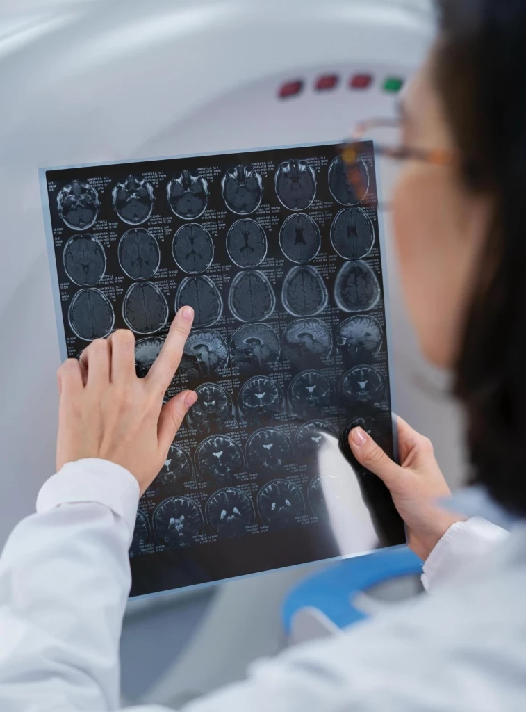 เจาะ 13 สาเหตุ “เลือดออกในสมอง” อันตรายถึงชีวิต ภาวะนี้มีสัญญาณเตือนหรือไม่