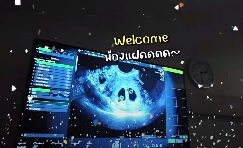 ดีใจน้ำตาคลอเบ้า แดน-แพทตี้ คอนเฟิร์มแล้วประกาศข่าวดีได้ลูกแฝดรับปีมังกร