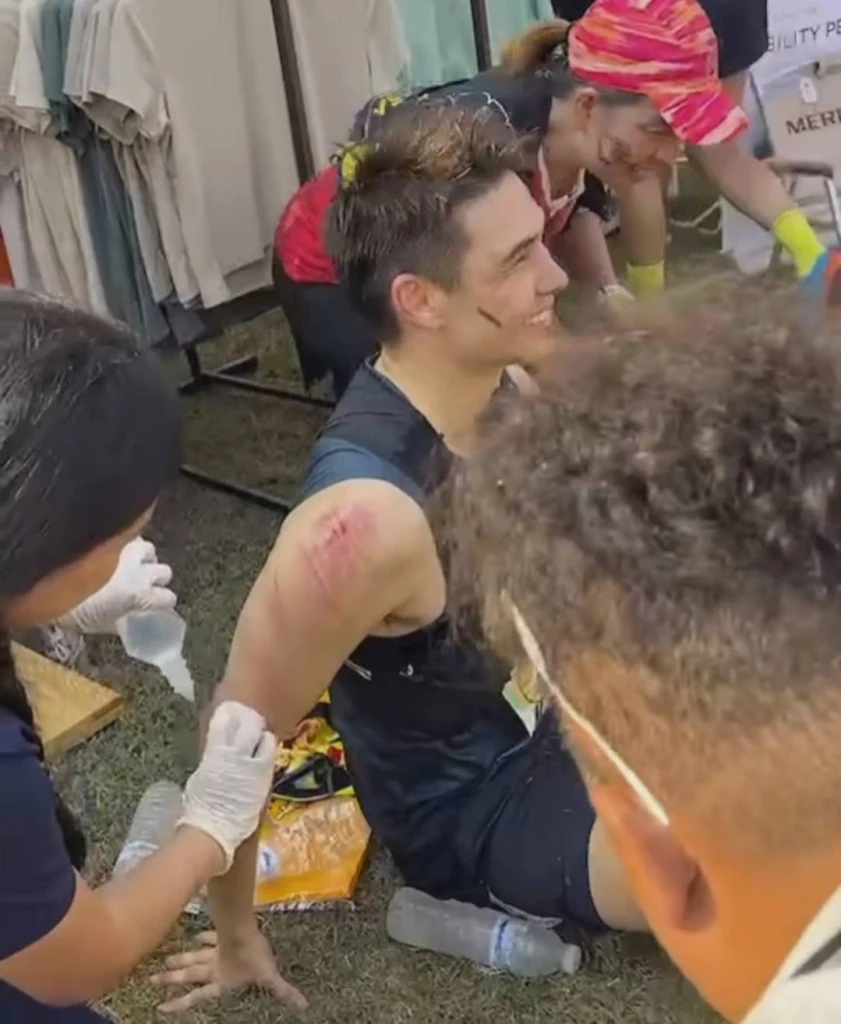 แห่เป็นห่วง แมทธิว ดีน หลังประสบอุบัติเหตุ แฟน ๆ เห็นแผลแล้วแสบแทน