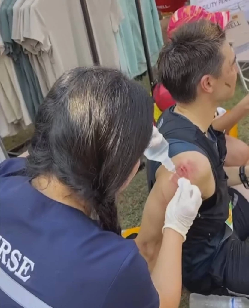 แห่เป็นห่วง แมทธิว ดีน หลังประสบอุบัติเหตุ แฟน ๆ เห็นแผลแล้วแสบแทน