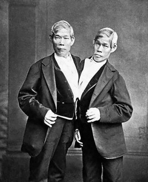 แฝด อิน-จัน