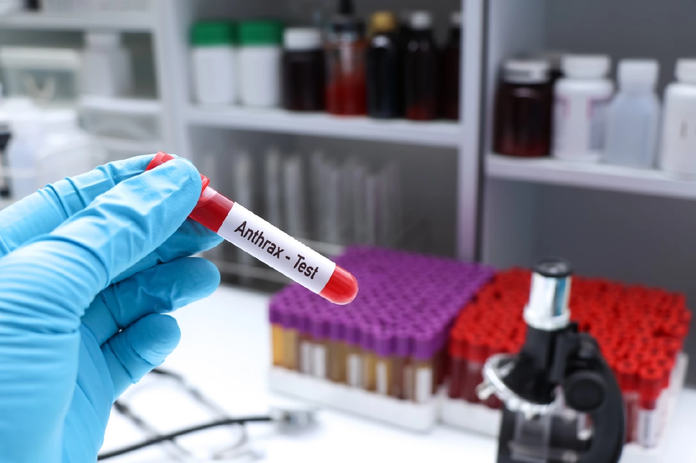 ทำความรู้จัก "โรคแอนแทรกซ์" คืออะไร ใครเสี่ยง และวิธีป้องกัน