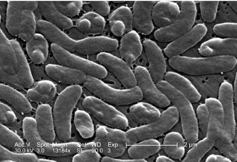 แบคทีเรียกินเนื้อคน ไม่ได้มีชนิดเดียว "หมอยง" ชี้เกิดกับผู้ภูมิคุ้มกันต่ำ