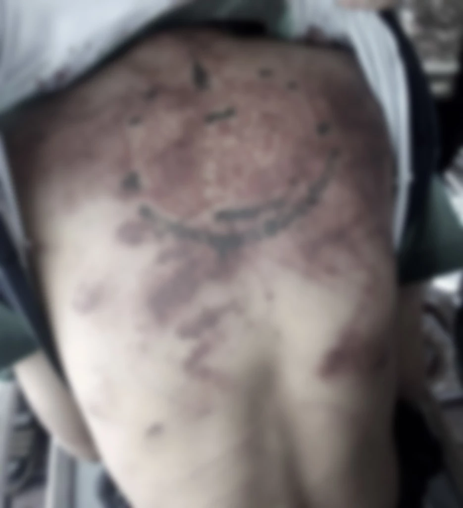 โจ๋วัย 20 ให้น้องชายรุมซ้อมเมีย เจ็บสาหัส ซ้ำขังให้อดน้ำ อดอาหาร 5 วัน