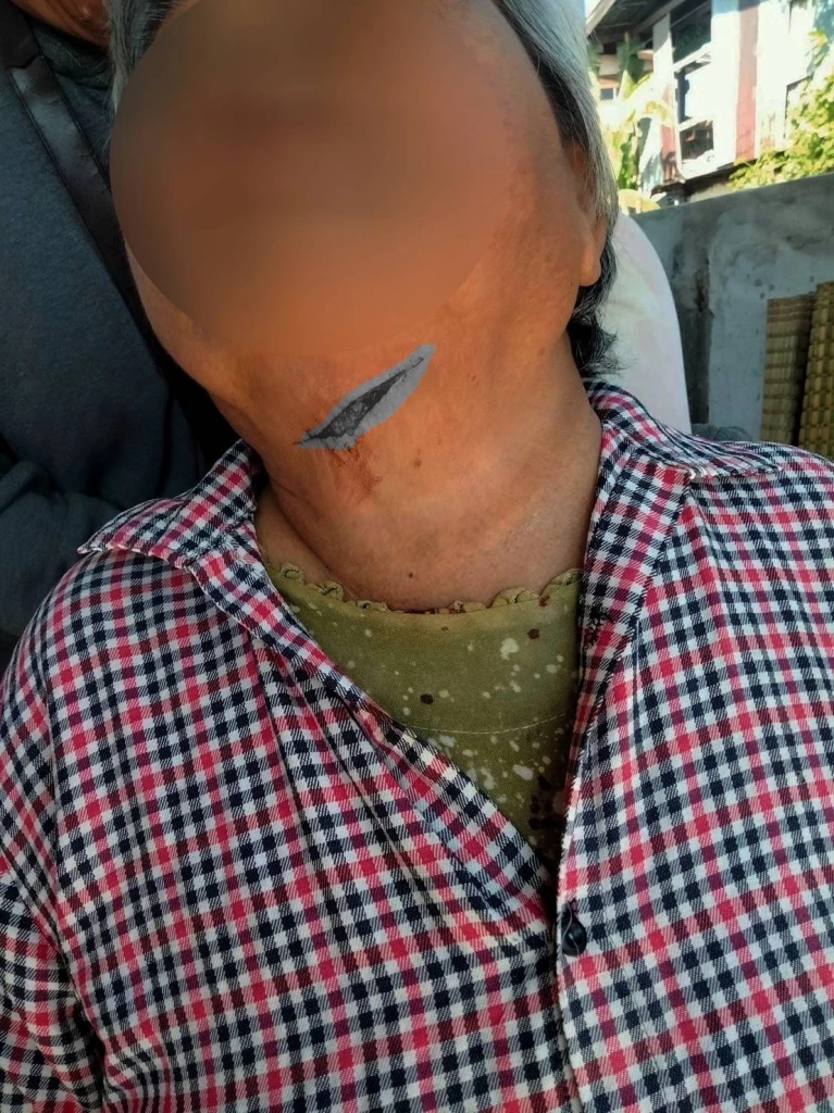 ระทึกทั้งหมู่บ้าน "หนุ่มป่วยจิตคลั่ง" ใช้มีดปาดคอยายข้างบ้านหวิดดับ