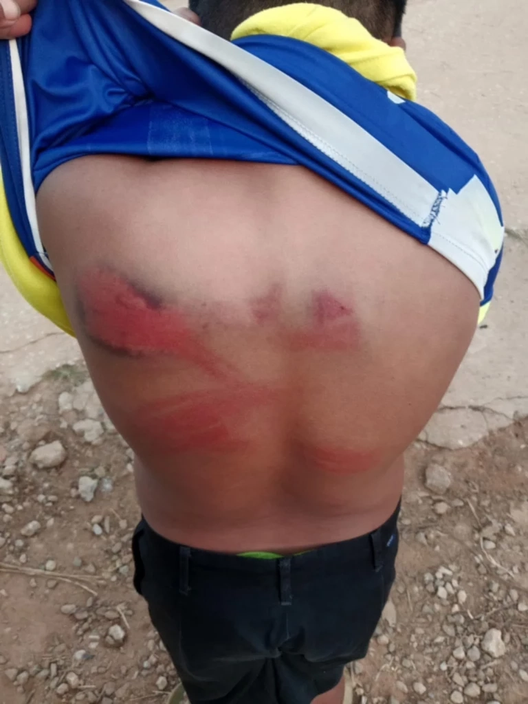 ชาวบ้านสุดทน ขับไล่ ครู รร.ตชด. ตีนักเรียน บอบช้ำจนหวาดผวา