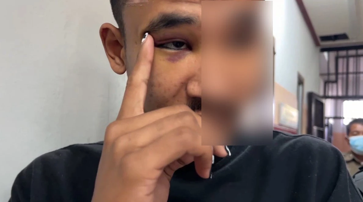 ฝากขัง "โจ้" มือยิงหัวหน้าการ์ดผับดับ ยอมรับกลัวอิทธิพลคู่กรณี