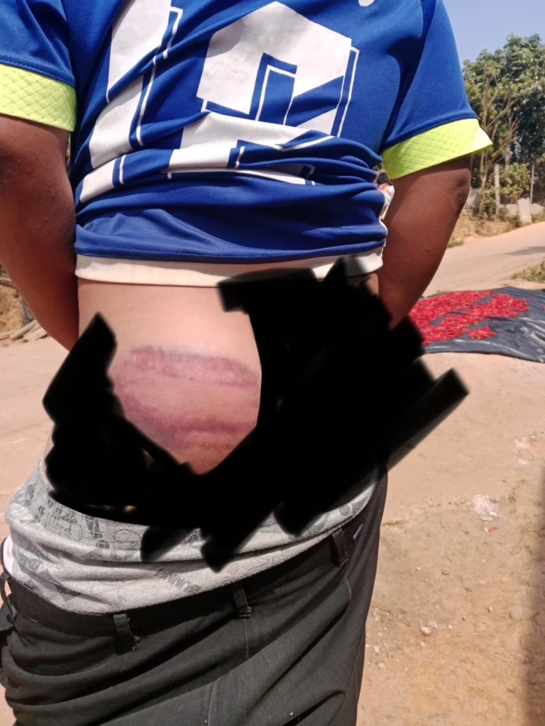 ชาวบ้านสุดทน ขับไล่ ครู รร.ตชด. ตีนักเรียน บอบช้ำจนหวาดผวา