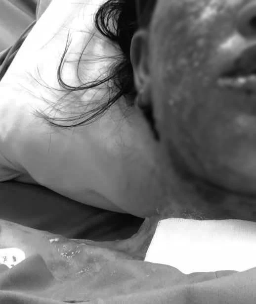 หมอเผยเป็นโรคนี้! เพจดังโพสต์เตือนภัย สาวแพ้ยาขั้นรุนแรง