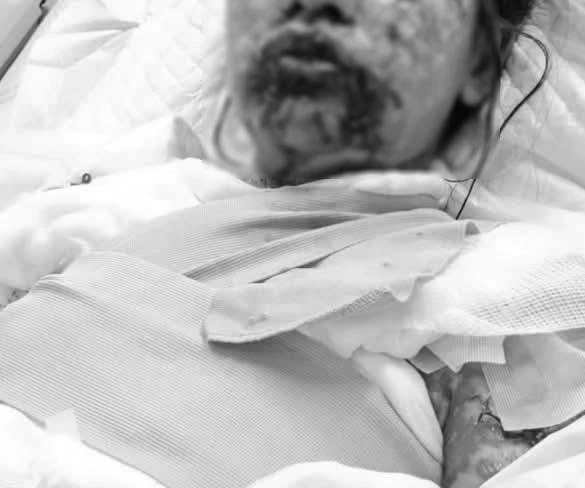 หมอเผยเป็นโรคนี้! เพจดังโพสต์เตือนภัย สาวแพ้ยาขั้นรุนแรง