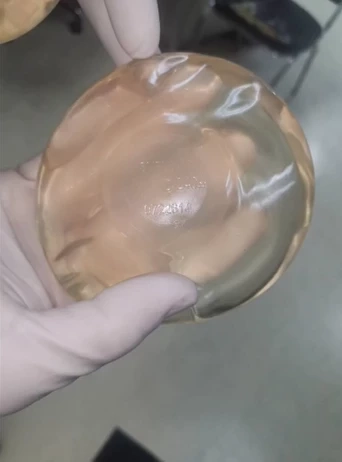 สาวผมแดงถูกยัดกระเป๋า ยิ่งสืบยิ่งยาก ตร.เร่งตามรอยจากจมูกที่เหลา