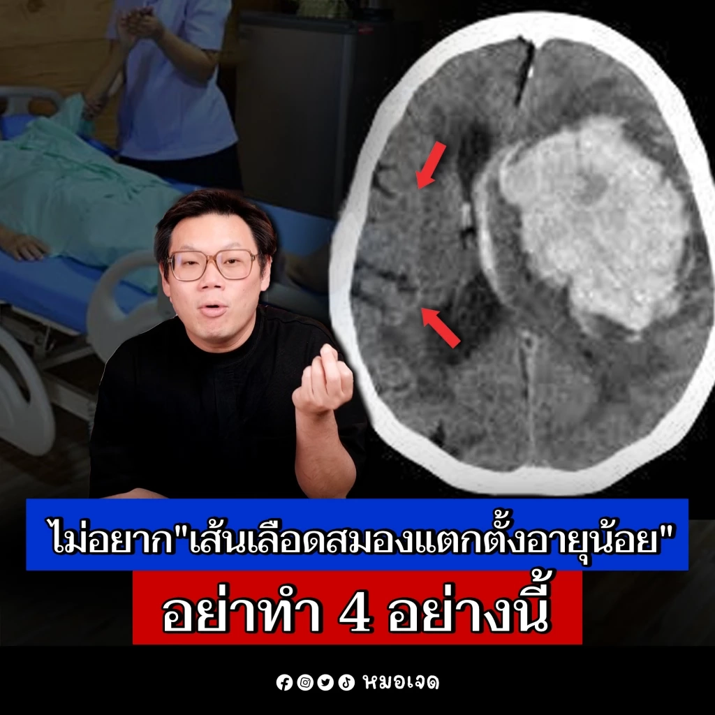 ขอบคุณภาพจาก : เฟซบุ๊ก หมอเจด