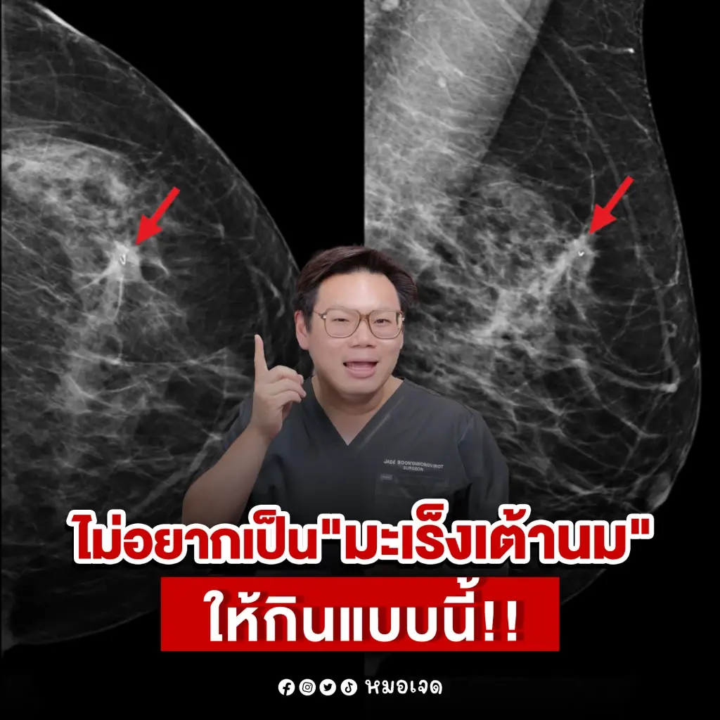 ขอบคุณภาพจาก : เฟซบุ๊ก หมอเจด