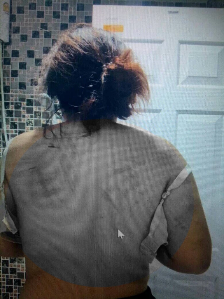 ยังไง! สาวใช้ถูกนายจ้างทารุณ เพื่อน-ตร.พูดคนละเรื่องกับเหยื่อ