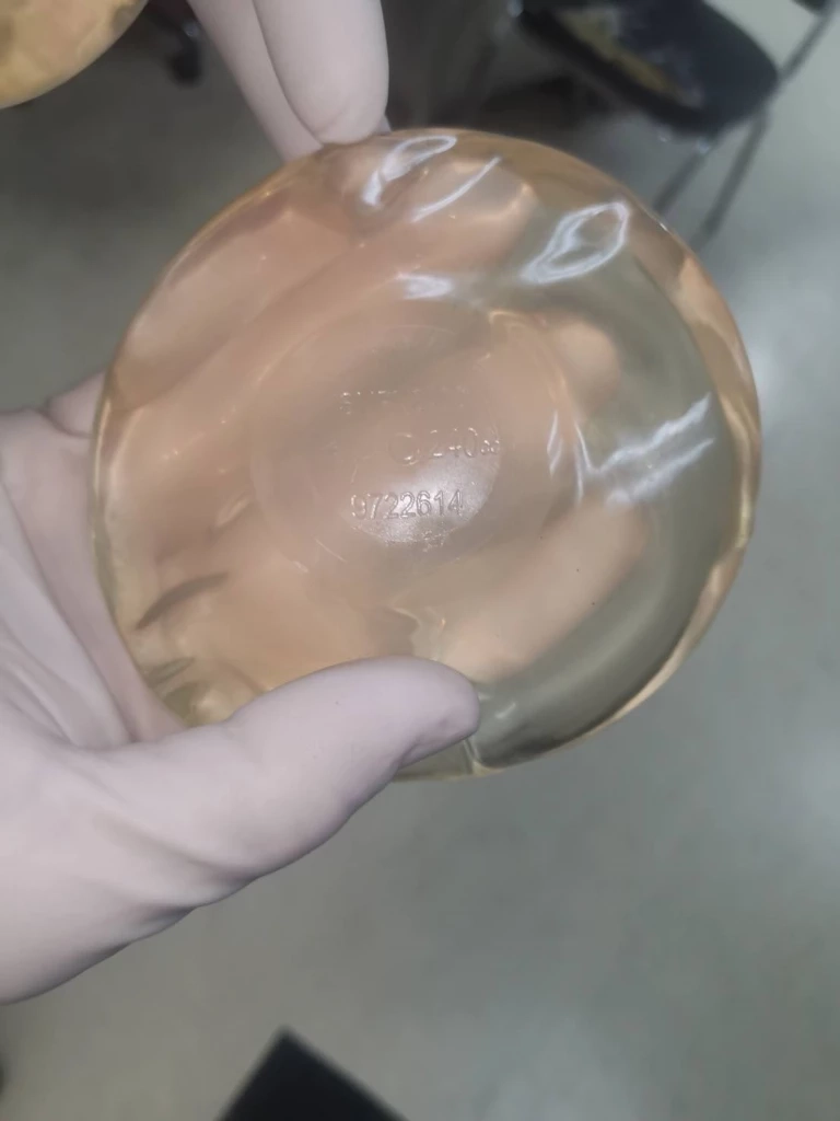 ซีเรียลนัมเบอร์ซิลิโคน หญิงถูกฆ่ายัดกระเป๋า ชัดแหล่งผลิต ยิ่งสืบยิ่งไกล