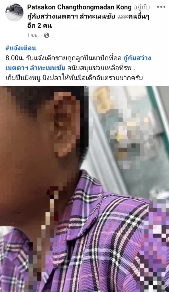 อุทาหรณ์ ด.ช.11 ขวบเล่นปืนยิงปลา พลาดลั่นไกลูกศรปักคอ