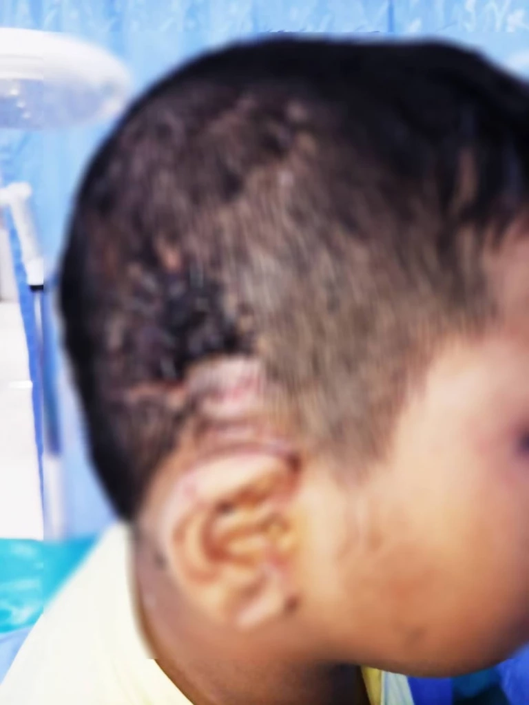 เหยื่อ "พิตบูล" ขย้ำ 10 ขวบ เจ็บสาหัส เตรียมร้อง “ผู้ช่วย รมว.สาธารณสุข”