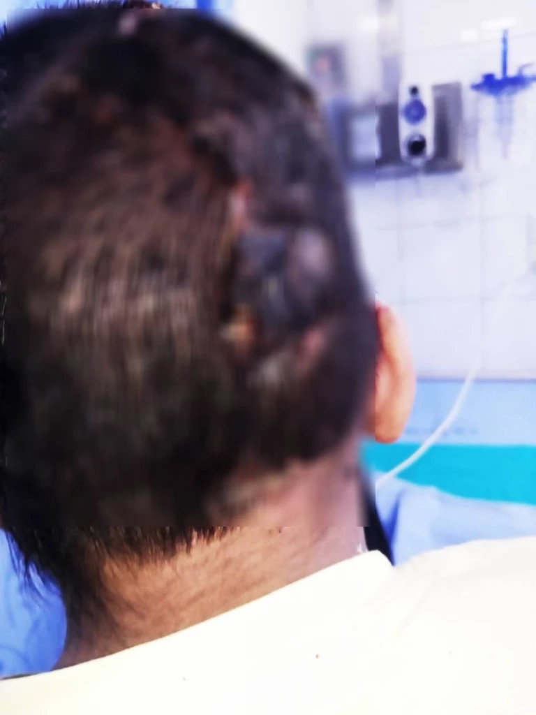 เหยื่อ "พิตบูล" ขย้ำ 10 ขวบ เจ็บสาหัส เตรียมร้อง “ผู้ช่วย รมว.สาธารณสุข”