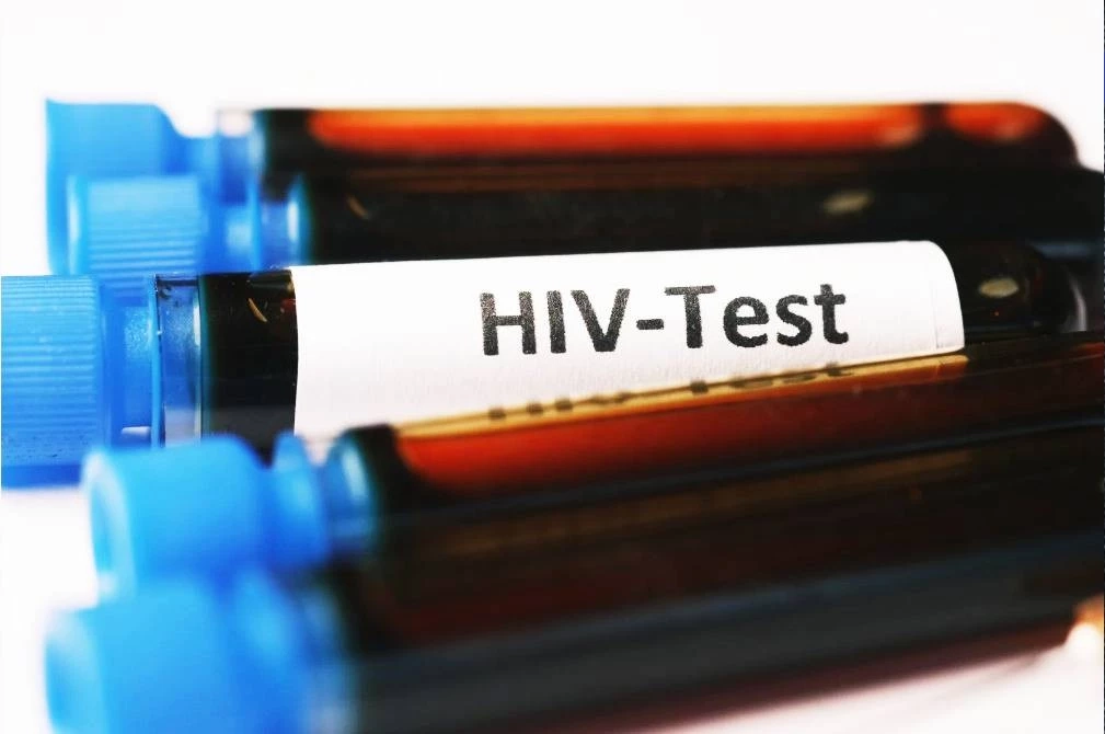 รักสนุกไม่ป้องกัน! สสจ.มหาสารคาม เตือน "HIV-ซิฟิลิส" ระบาดหนักกลุ่ม "วัยรุ่น-นศ."