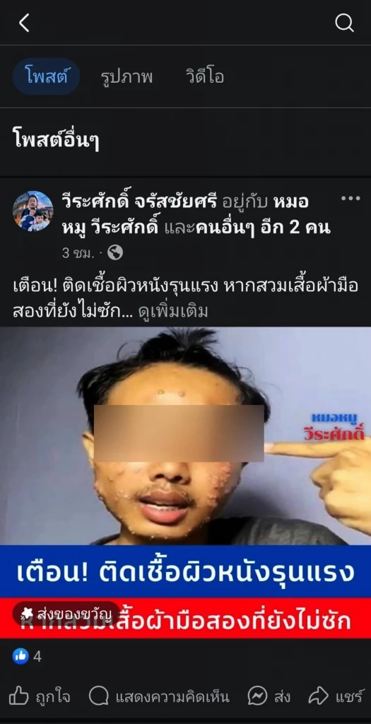 เตือน! "หมอหมู" ระบุุติดเชื้อผิวหนังรุนแรง หากสวมเสื้อผ้ามือสองที่ยังไม่ซัก