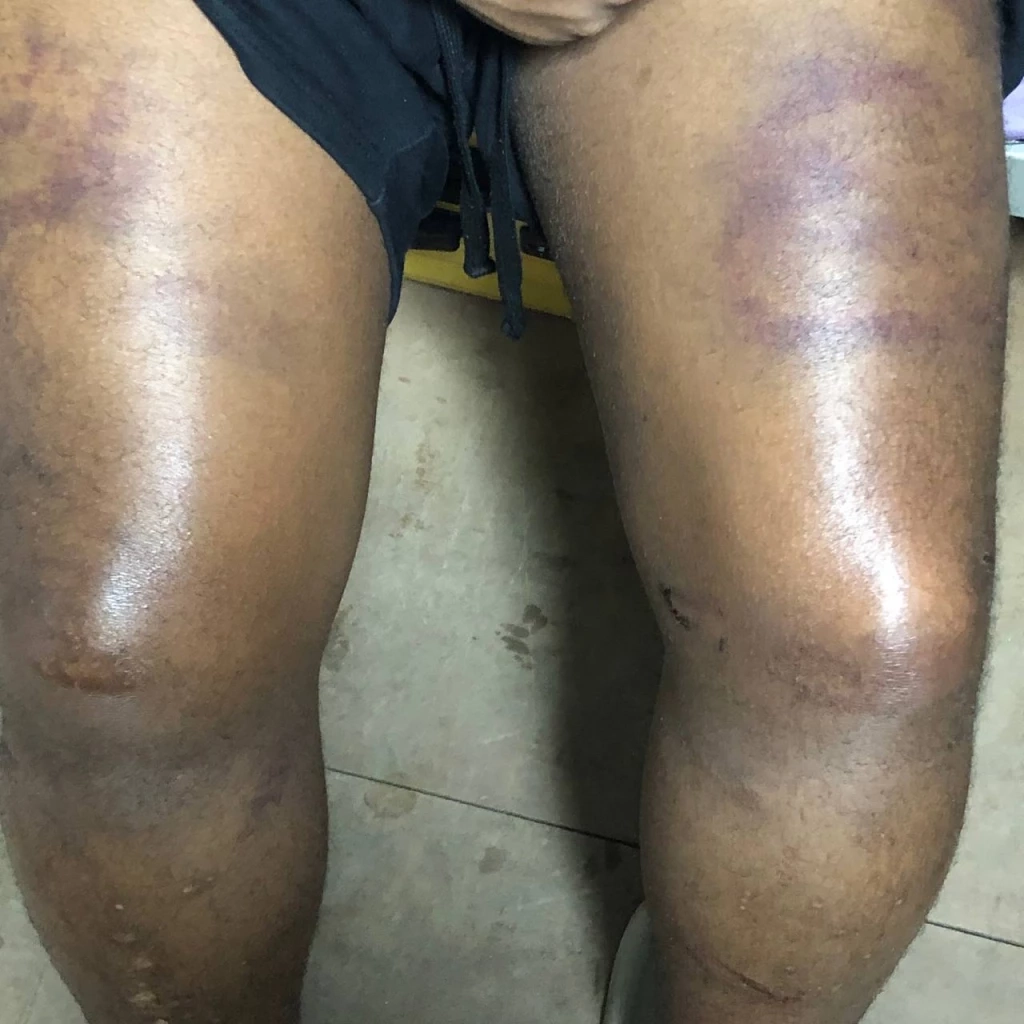 เปิด 3 พิกัด แหล่งกบดาน แก๊งคอลเซ็นเตอร์ มาเฟียจีนสุดโหด