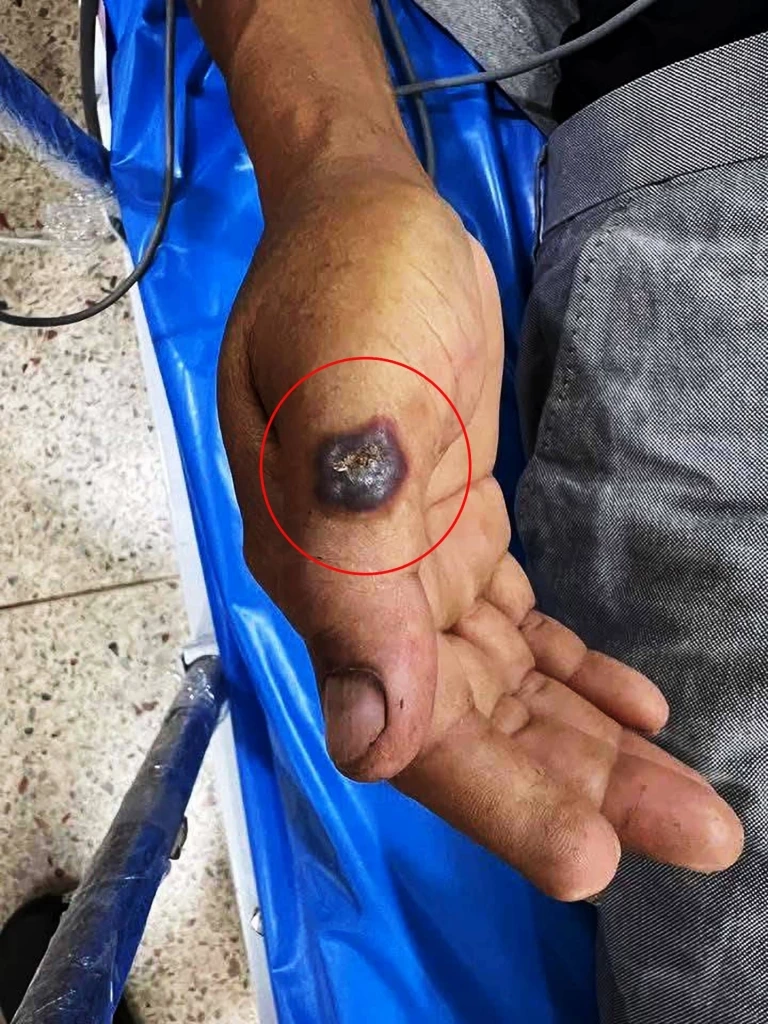 "สสจ.มุกดาหาร" ประกาศชื่นชม "หมอหนุ่ม" วินิจฉัย "โรคแอนแทรกซ์" แม่นยำก่อนลุกลาม