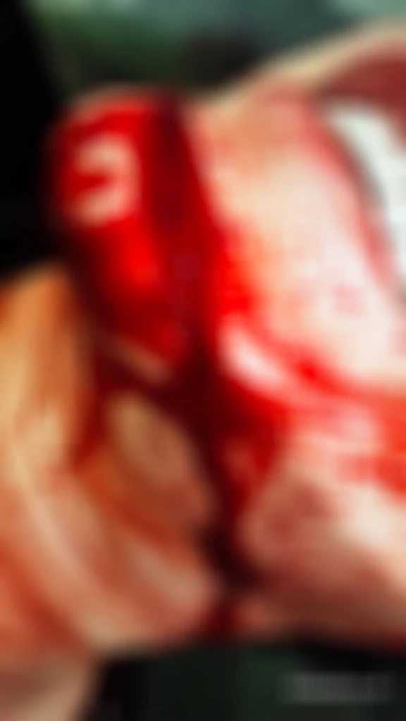 "เป๊ก ผลิตโชค" นักร้องชื่อดัง โดนแทงกลางปั๊มย่านรามคำแหง