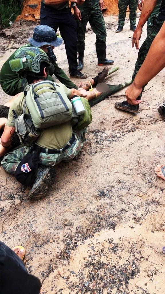 ด่วน! ทหารไทย เหยียบ "กับระเบิด" ที่เนิน 350 "ปราสาทตาควาย" สาหัส 1 นาย